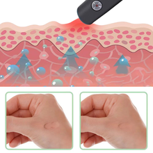 Load image into Gallery viewer, Stichweg - zur effektiven Behandlung von Insektenstichen- und bissen