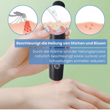 Load image into Gallery viewer, Stichweg - zur effektiven Behandlung von Insektenstichen- und bissen
